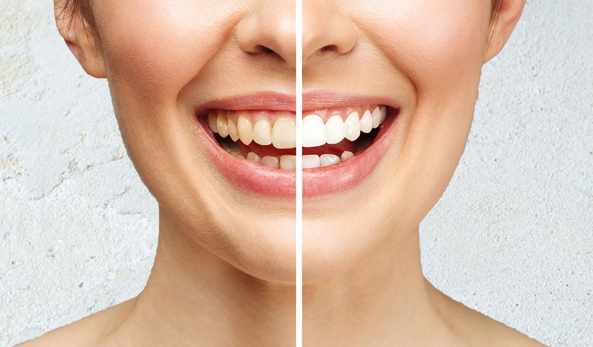Cosmetic-dentistry-