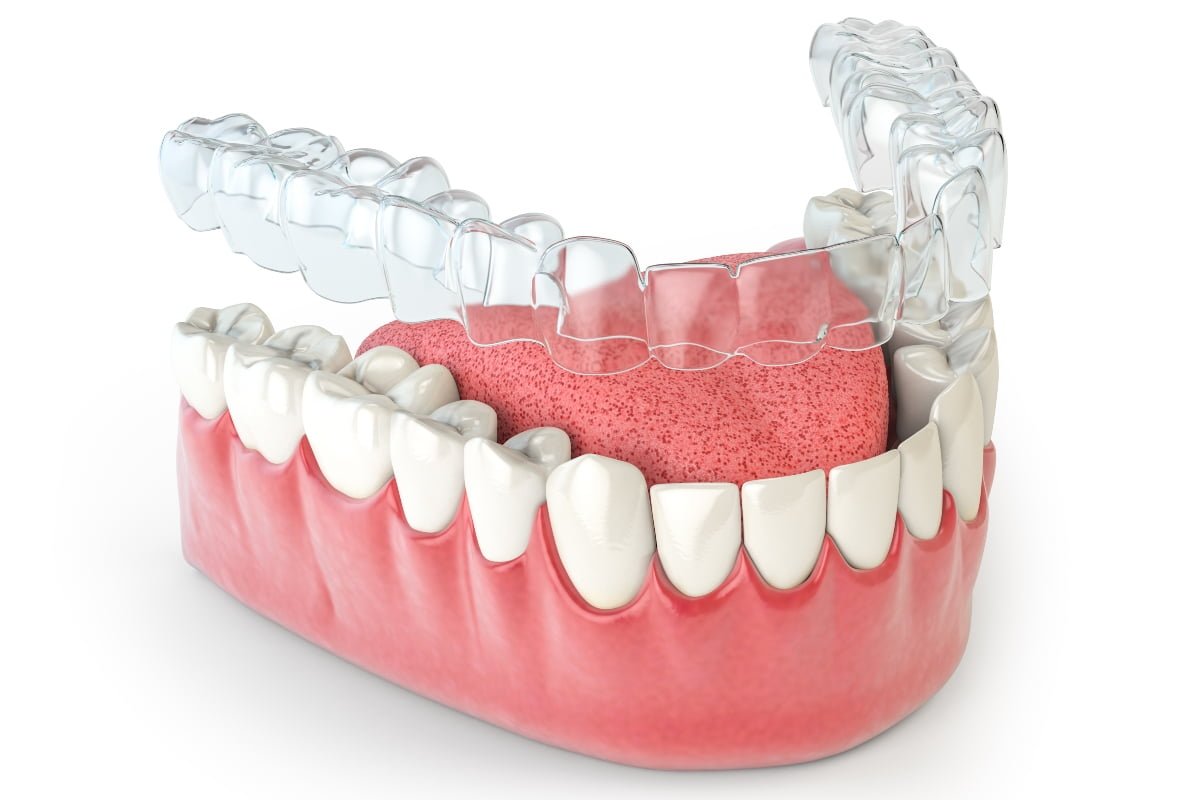 Expert Dentists