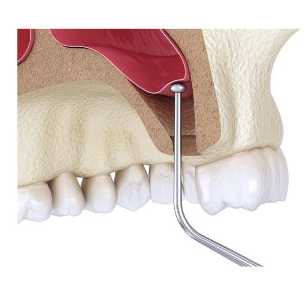 Healthy Teeth