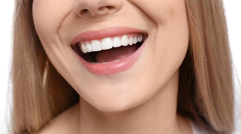 straighter-smile